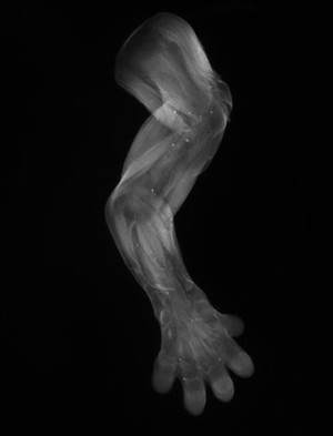view Embryonic mouse limb