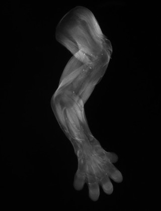 Embryonic mouse limb