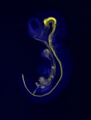 Developing neural tube