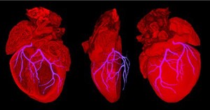 view Mouse heart showing position of coronary arteries