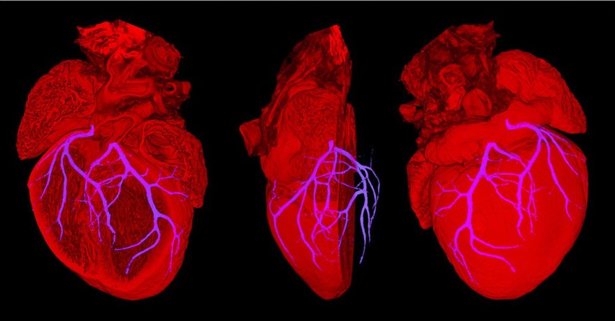 Mouse heart showing position of coronary arteries