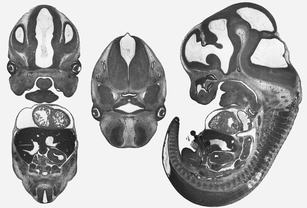 Sections of developing mouse embryo