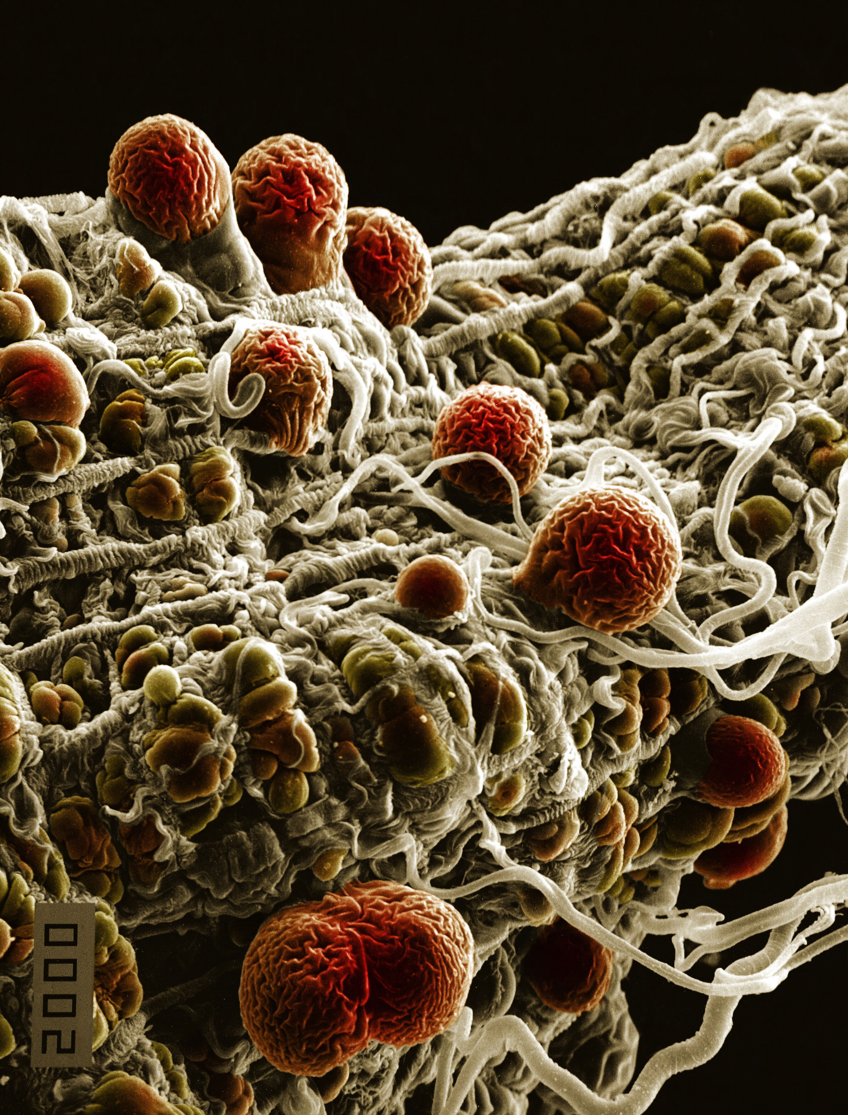 Malaria parasites Wellcome Collection