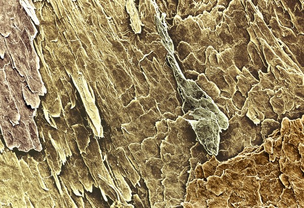 structure of nail