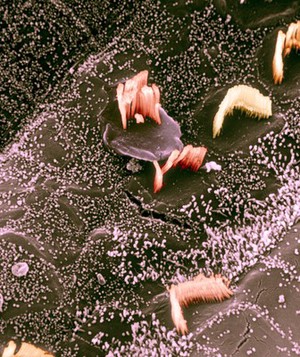 view Inner ear hair cell damage