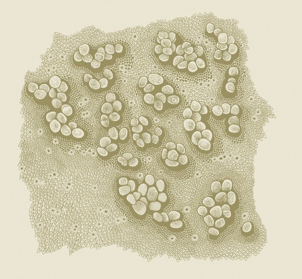 Chancroid