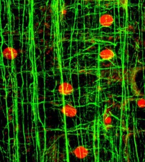 Microfilaments