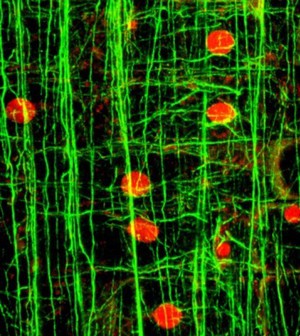 view Microfilaments