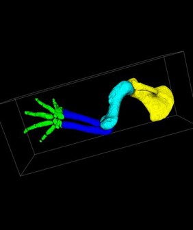 14.5 dpc mouse forelimb