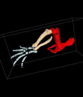 Bones of a mouse hindlimb