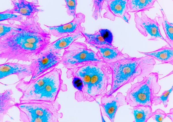 Bovine pulmonary artery cells