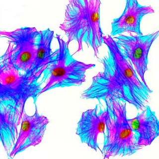 HeLa cells