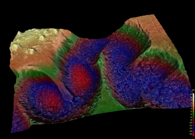 Osteoclast pit