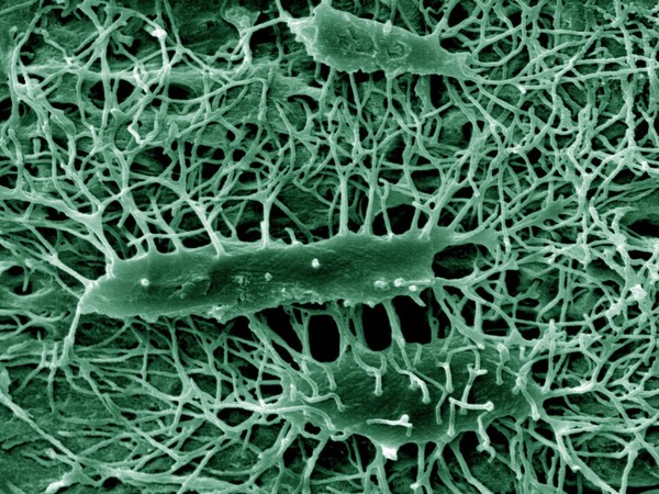 Osteocytes