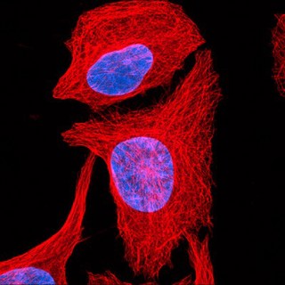 Human osteosarcoma cells