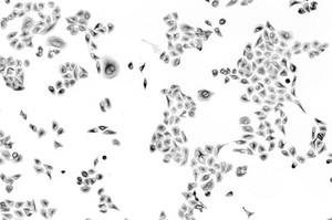 view Human osteosarcoma cells