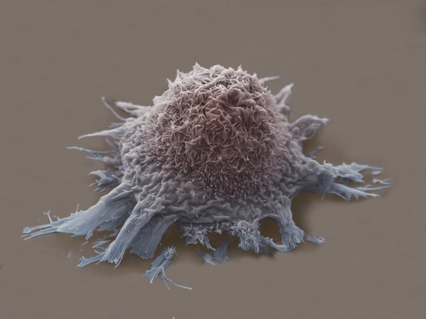 Lung cancer cell
