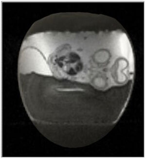 view 3D MRI of a six-day-old quail embryo alive inside its egg.