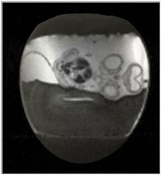 3D MRI of a six-day-old quail embryo alive inside its egg.