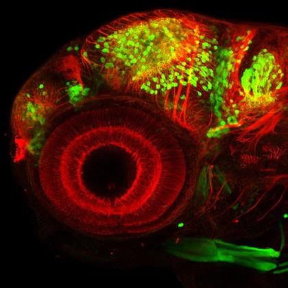 Lateral view of a zebrafish embryo