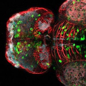 view Dorsal view of a zebrafish brain