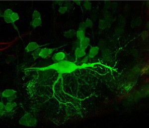 view Reticulospinal neuron