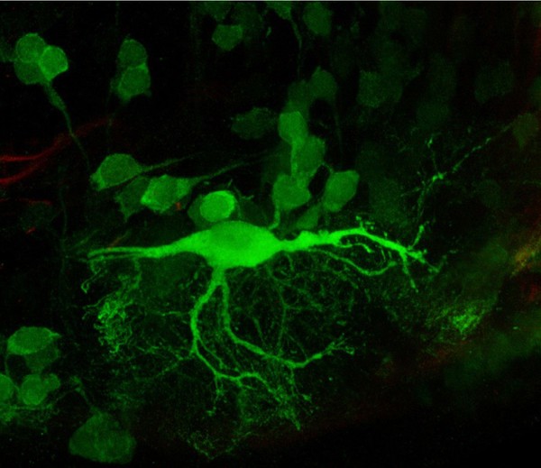 Reticulospinal neuron