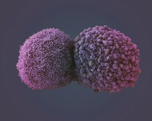 view Lung cancer cells