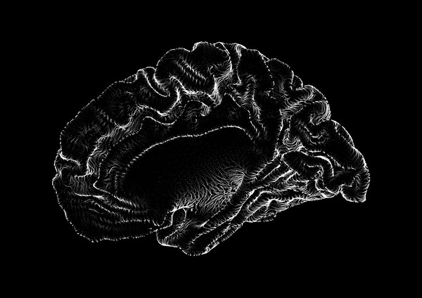 Surface detail of a human brain