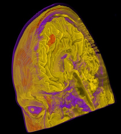 Human brain activation due to voluntary action