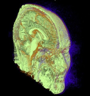 view Structure of human head and brain