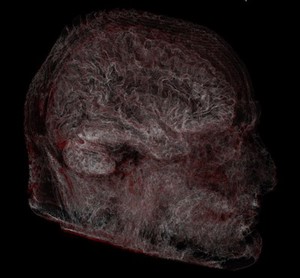 view Structure of human head and brain