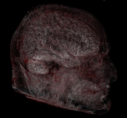 Structure of human head and brain