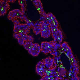 Ferret choroid plexus infected with Canine Distemper Virus