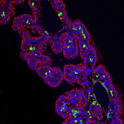 Ferret choroid plexus infected with Canine Distemper Virus