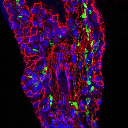 Ferret choroid plexus infected with canine distemper virus