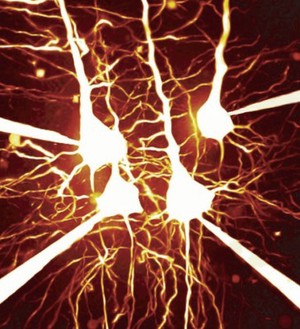 view Pyramidal neurons