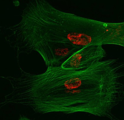 Primary human fibroblasts