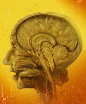 Cross section of human cranium