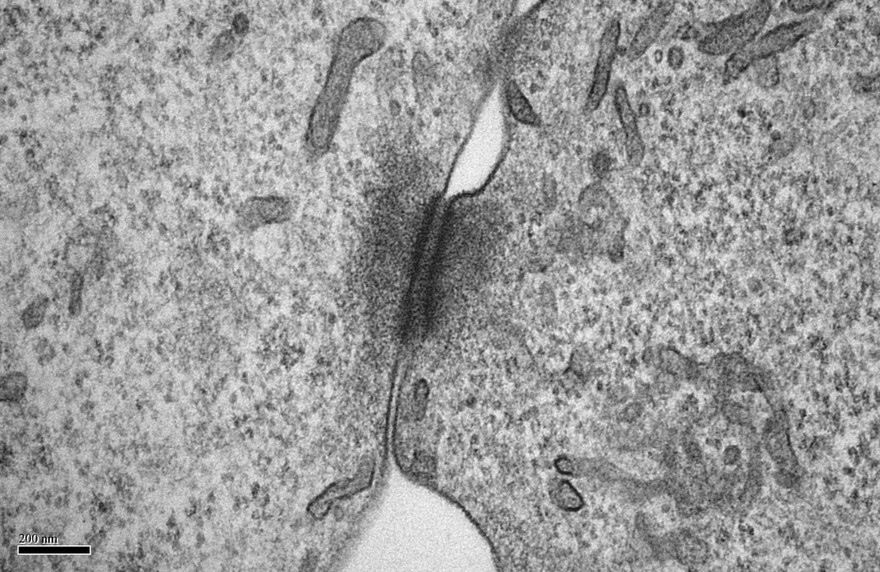 cellular communication: cell junction