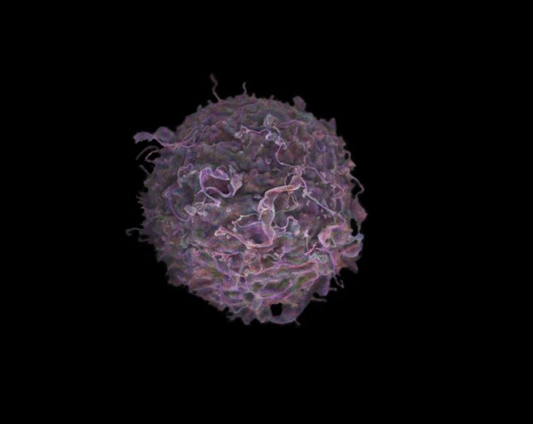 Breast cancer cell