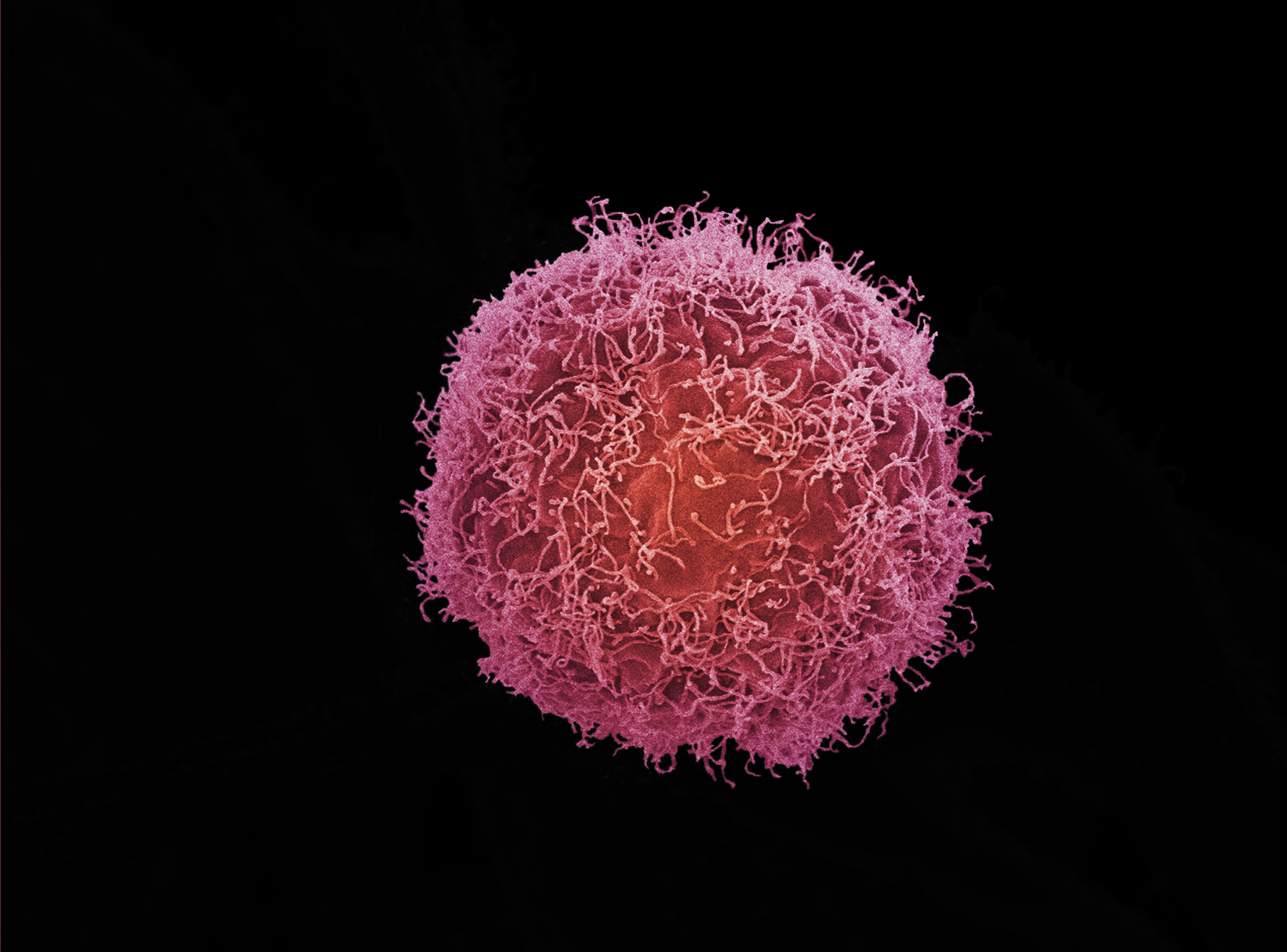 Skin Cancer Cell Wellcome Collection 