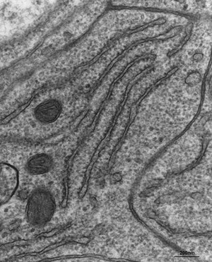 view Rough endoplasmic reticulum in the retina of a fruit fly