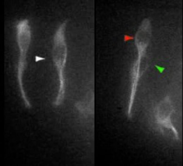 Movie: stem cell division and neuronal birth
