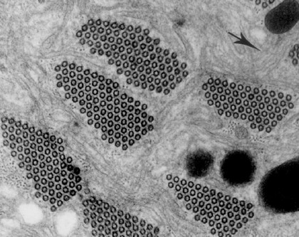 Microtubule bundles in a rumen ciliate