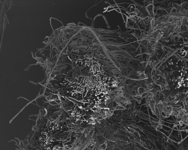 String