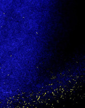 view Confocal micrograph of E. coli