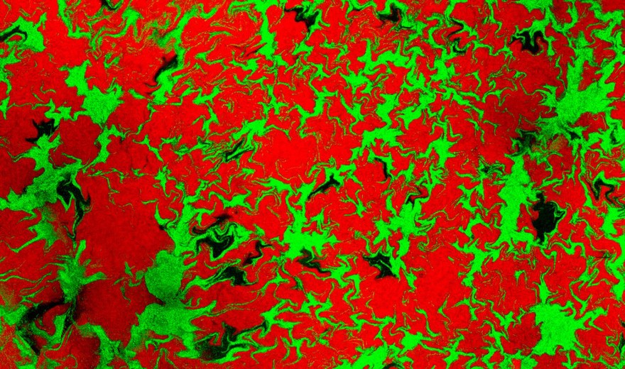 Confocal micrograph of E. coli