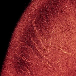 view Confocal micrograph of E. coli