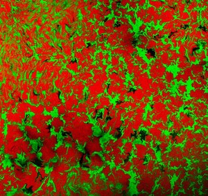 view Confocal micrograph of E. coli